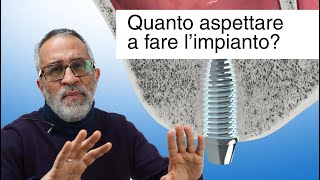 Impianto dentale quanto aspettare dopo lestrazione [upl. by Edmon]