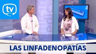 MedicinaTV  67 Las linfadenopatías [upl. by Nitsoj]