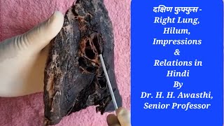 दक्षिण फुफ्फुस  Right Lung Hilum Impressions amp Relations By Dr H H Awasthi Senior Professor [upl. by Ecnahoy]