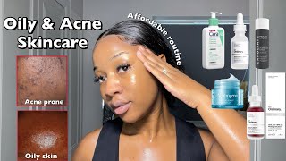 SKINCARE ROUTINE FOR OILY ACNEPRONE SKIN  A routine for smooth amp clear Skin ‼️ [upl. by Kathi]