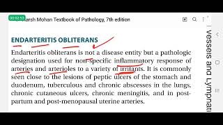 Endarteritis obliterans in Hindi  pathology lectures [upl. by Lehteb82]