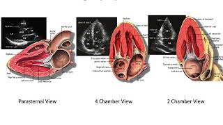 BENG280C Lecture 6 Echocardiography Applications [upl. by Rhines]