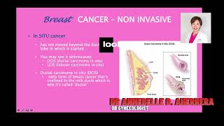 DUCTAL CARCINOMA IN SITU [upl. by Avner]