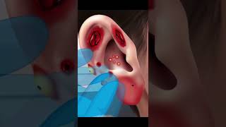 ASMR Ear Piercing Cleaning Earwax Removal for an Idol shorts asmr earcleaning earpiercing [upl. by Braynard]