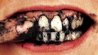 DONT DO THIS TO YOUR TEETH [upl. by Ric]