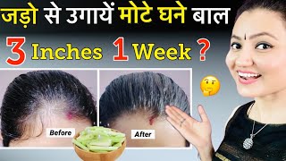 30 Days quotExtreme Hair Growthquot Challenge  बेजान Bald पड़ चुकी जड़ो से भी होगी कमाल की Hair Growth❤️ [upl. by Nniroc]