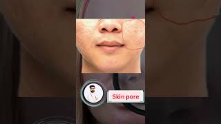 How to Remove open skin pores [upl. by Huntingdon]