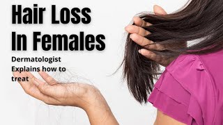 Hair Loss in women  Causes amp Treatment [upl. by Gorges]