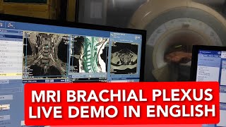 Brachial plexus MRI scan protocol positioning and planning on GE 15 Tesla  Live Demo in English [upl. by Ykcul825]