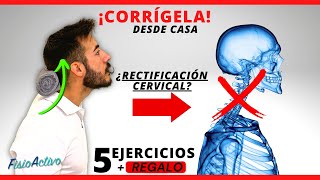 5 EJERCICIOS para la CORREGIR TU CUELLO ¡EN POCO TIEMPO 🩻  REGALO 🎁 [upl. by Eldred]