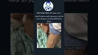 فحص مرونه الجلدskin turgor test دكتورسيرجن اكسبلور explore [upl. by John]