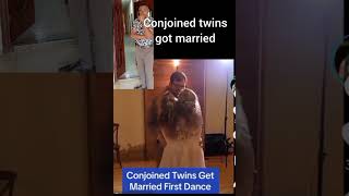 Conjoined twins got married [upl. by Nela]