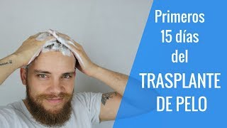 TRASPLANTE DE PELO  ¿QUÉ HACER LOS PRIMEROS DÍAS ¿QUÉ PUEDES SUFRIR [upl. by Alverta811]