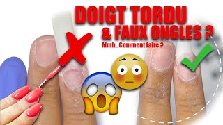 💅 DOIGT TORDU ET FAUX ONGLES  COMMENT FAIRE UN ONGLE DROIT  CAPSULES [upl. by Woodward411]