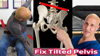 Fix Uneven Pelvis amp Hips in 60 Seconds  Dr Mandell [upl. by Holmen739]