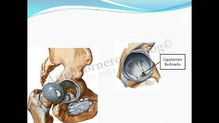 Articulación Coxofemoral [upl. by Zonda644]