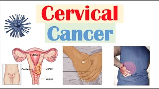 Cervical Cancer Risk Factors Pathophysiology Symptoms Staging Diagnosis Treatment amp Prevention [upl. by Sedaiuqlem]