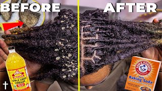 HOW TO ACV RINSE YOUR DREADLOCKS  Step By Step Tutorial [upl. by Asha]