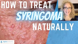 HOW TO TREAT SYRINGOMA Natural Remedies amp Medical Procedures [upl. by Karr]