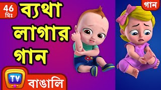 ব্যথা লাগার গান The Boo Boo Song  More Bangla Rhymes for Children  ChuChu TV [upl. by Bigford]