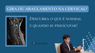 Giba ou abaulamento na Cervical Descubra o que é normal e quando se preocupar [upl. by Cioffred]