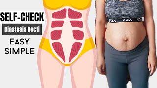 Super Simple SelfCheck Diastasis Recti both gap and depth [upl. by Aratak465]