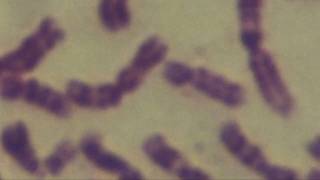 Cytogenetics Human chromosomes Karyotype [upl. by Nicks]