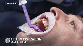 Dental Clinical Procedure for Single Unit Crown  Chapter 2 Bite registration [upl. by Anaihs]