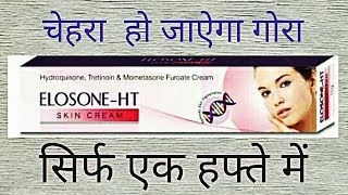 Elosone HT Cream Review Side Effects UsesBest Fairness Cream For Marks [upl. by Ayalat]