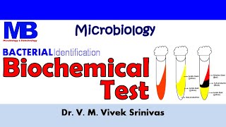 BIOCHEMICAL TEST  Bacterial Identification Technique  Microbiology  Vivek Srinivas Bacteriology [upl. by Jacki719]