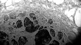 Spontaneous contraction of cardiomyocytes differentiated from End2induced precardiac mesoderm [upl. by Argella]