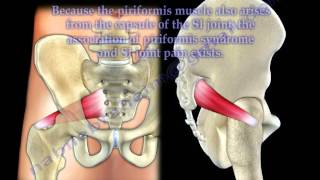 Piriformis syndrome or true sciatica  Everything You Need To Know  Dr Nabil Ebraheim [upl. by Neimad]