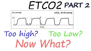 Capnography Waveform Interpretation Advanced  Why perfusion matters [upl. by Russom]