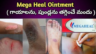 Mega Heal Ointment Uses in Telugu గాయాలను పుండ్లని తగ్గించే మెగా హీల్ జెల్ ఉపయోగాలు [upl. by Ethelstan550]