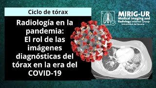 Rx en la pandemia El Rol de las Imágenes diagnósticas del tórax en la era del Covid19  MIRIGUR [upl. by Sipple]