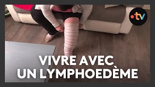 Vivre avec une maladie orpheline  le lymphœdème [upl. by Niko]