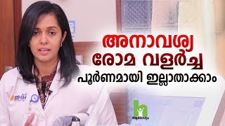 അനാവശ്യ രോമ വളർച്ച പൂർണമായും ഇല്ലാതാക്കാം  Laser Hair Removal Malayalam Health Tips [upl. by Raynata]