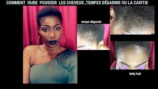 COMMENT FAIRE POUSSER LES CHEVEUX AVEC LURINE FERMENTÉE \tempes dégarnies \ calvitie [upl. by Kyla]