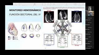 Seminario Imagen Cardiaca Monitoreo hemodinámico por ecocardiografia [upl. by Atse]