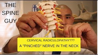 CERVICAL STENOSIS RADICULOPATHY PART 1  SYMPTOMS IMAGING AND PATIENT EXAM [upl. by Ahsyia]