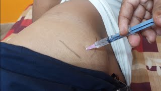 IM इंजेक्शन देने का सही तरीका  Easy steps to give Intramuscular injection  IM injection technique [upl. by Retep]