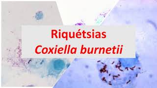 Microbiologia Médica Riquétsias e Coxiella burnetti [upl. by Acined232]