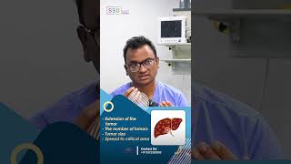 Liver Metastasis from Colon amp Rectal Cancer Available Treatment Options  Dr Praveen Kammar [upl. by Airolg713]