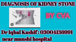 Diagnosis of kidney stones۔۔۔by Costovertebral angle tenderness۔ [upl. by Lempres667]