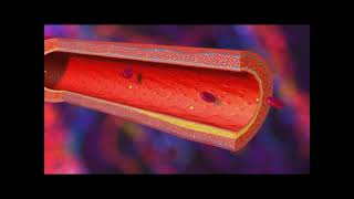 Infarctus du myocarde  IDM [upl. by Shelman]