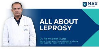 All about Leprosy  Max Hospital [upl. by Reneta]