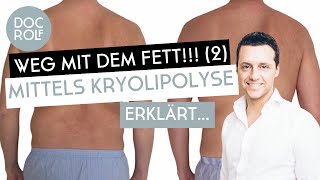 KRYOLIPOLYSE BEHANDLUNG – Fett weg Teil 2 mit Dr Rolf Bartsch [upl. by Ahsieka163]