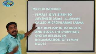 FILARIASIS  TAMIL  ELEPHANDIASIS  LYMPHOEDEMA  HUMAN HEALTH AMD DISEASES  STD 12  TNSCERT [upl. by Neelat]