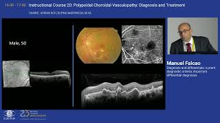 4 Diagnosis and differentials current diagnostic criteria important differential diagnoses [upl. by Anolla]