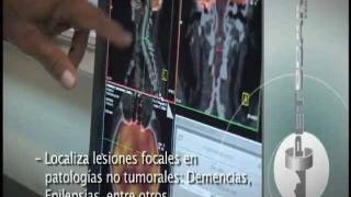 PETCT  Alta precisión en el diagnóstico del cáncer [upl. by Olegnaleahcim]